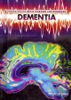 Go to record Dementia